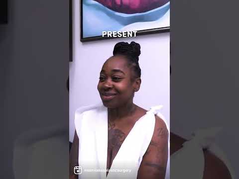 Must watch before you get a BREAST SURGERY at Miami Lakes Plastic Surgery