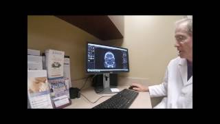 Review of a CT Scan with Dr. Simons
