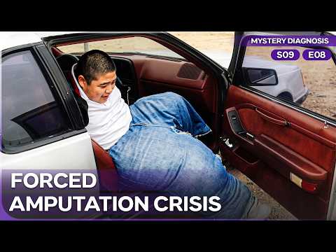 Rare Disease Left His Leg Weighing 150 Pounds | Mystery Diagnosis