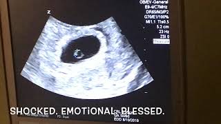 6 week ultrasound! Are we having twins?!