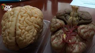 Zimbabwe Expands Brain Tumour Care as Doctors Warn Against Delayed Treatment Zimbabwe Expands Brain Tumour Care as Doctors Warn Against Delayed Treatment
