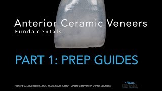 Anterior Ceramic Veneers, Part 1: Preparation Guides