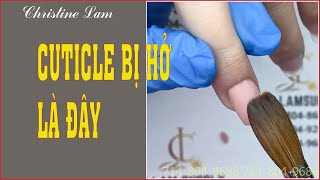 CHRISTINE LAM NAILS - NAIL CĂN BẢN - LÝ DO ĐẮP BỘT CUTICLE BỊ HỞ