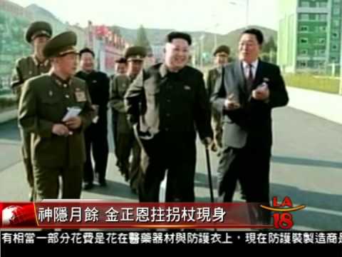 [金正恩神隱多日終於現身] 洛城18台晚間新聞 10142014