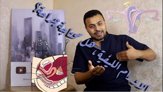 الاورام الليفية