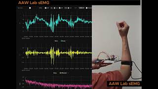 Part 2: how I build my wireless EMG device