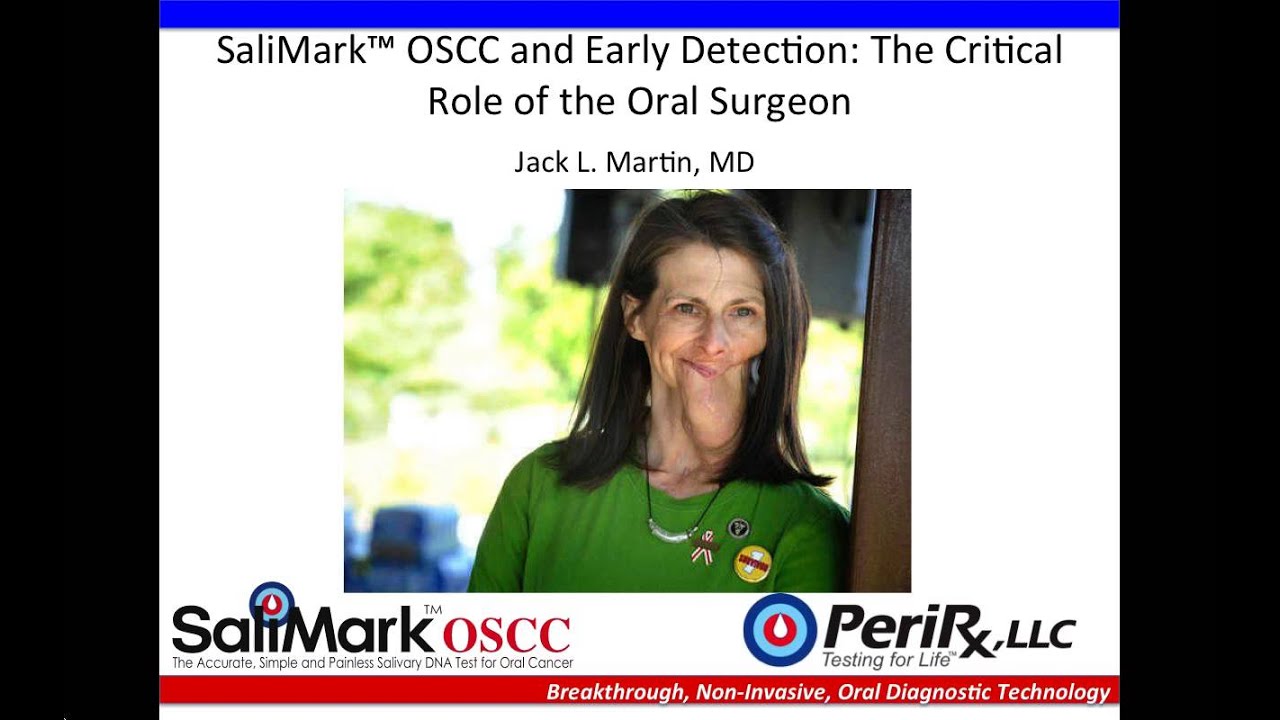 SaliMark™ OSCC and Early Detection  The Critical Role of the Oral Surgeon 2 3 16, 8 00 PM