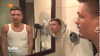 Barttransplantation Zdf Hallo Deutschland - Heimo Dominik