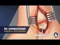 Motionlit animation  medical illustration samples