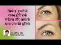 Wrinkles removal Home Remedy |झुरियौ से छुटकारा पाने का आसान तरीका | DR. MANOJ DAS