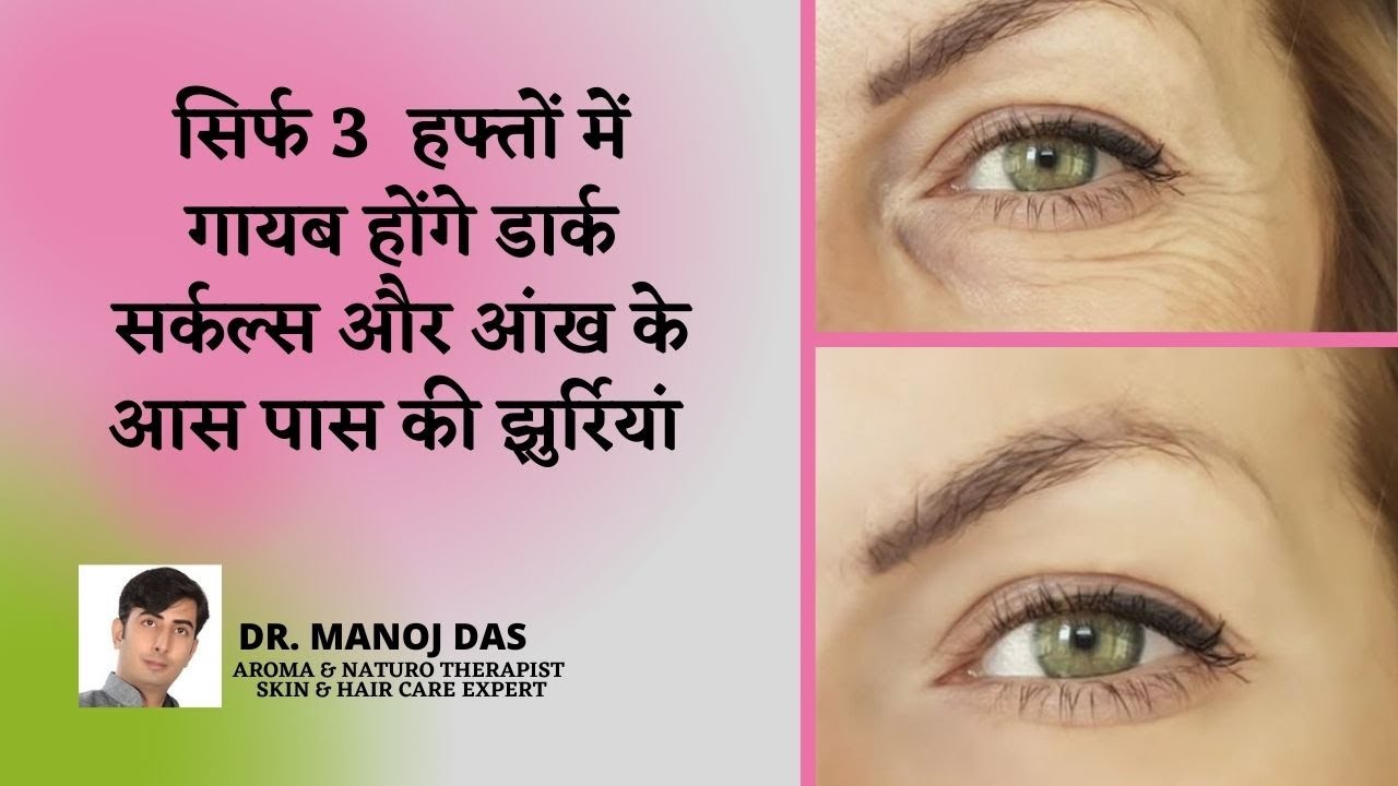 Wrinkles removal Home Remedy |झुरियौ से छुटकारा पाने का आसान तरीका | DR. MANOJ DAS