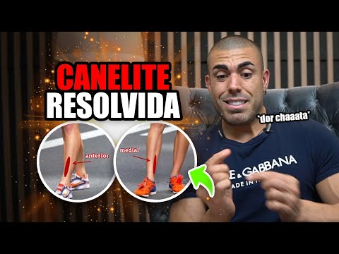 Vídeo: 4 maneiras simples de prevenir dores nas canelas ao correr