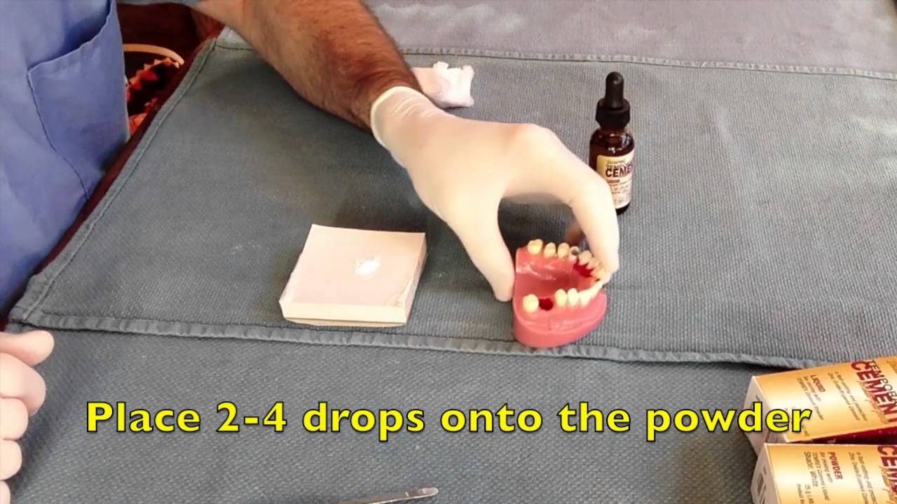 The Dental BoxCaries YouTube