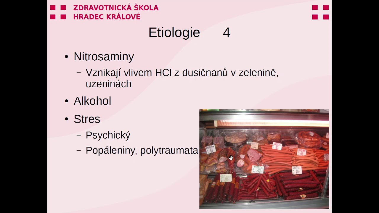 Vředová choroba žaludku a duodena