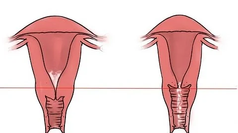 ¿Cómo se comprueba la ovulación en el cuello del útero?