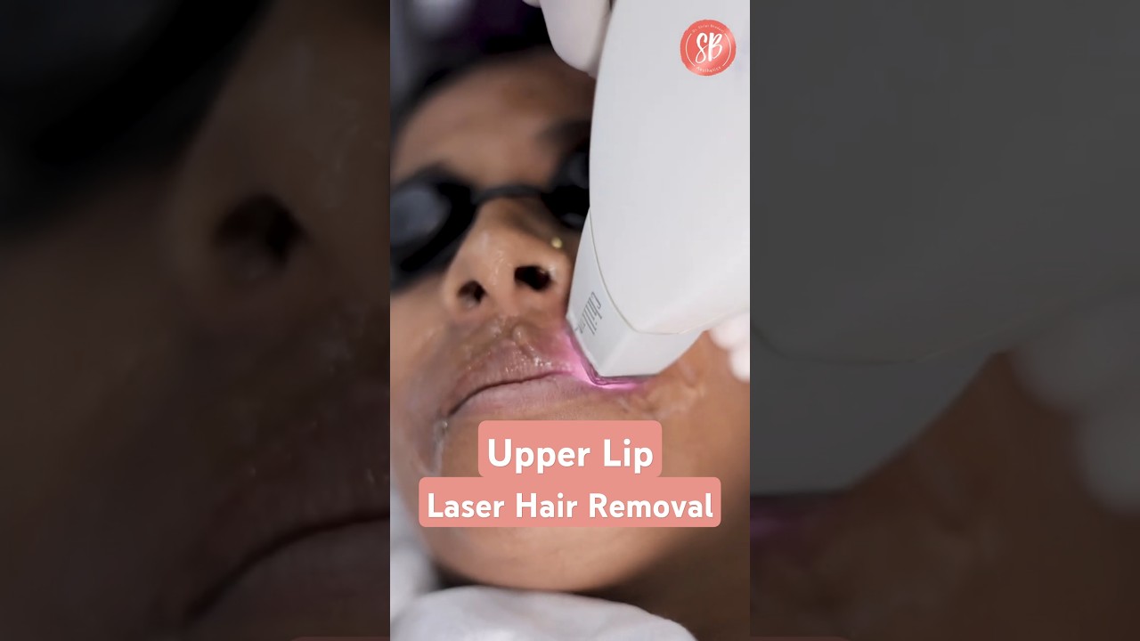 Laser Hair Removal for Women | Upper Lip Laser Hair Reduction | SB Aesthetics 