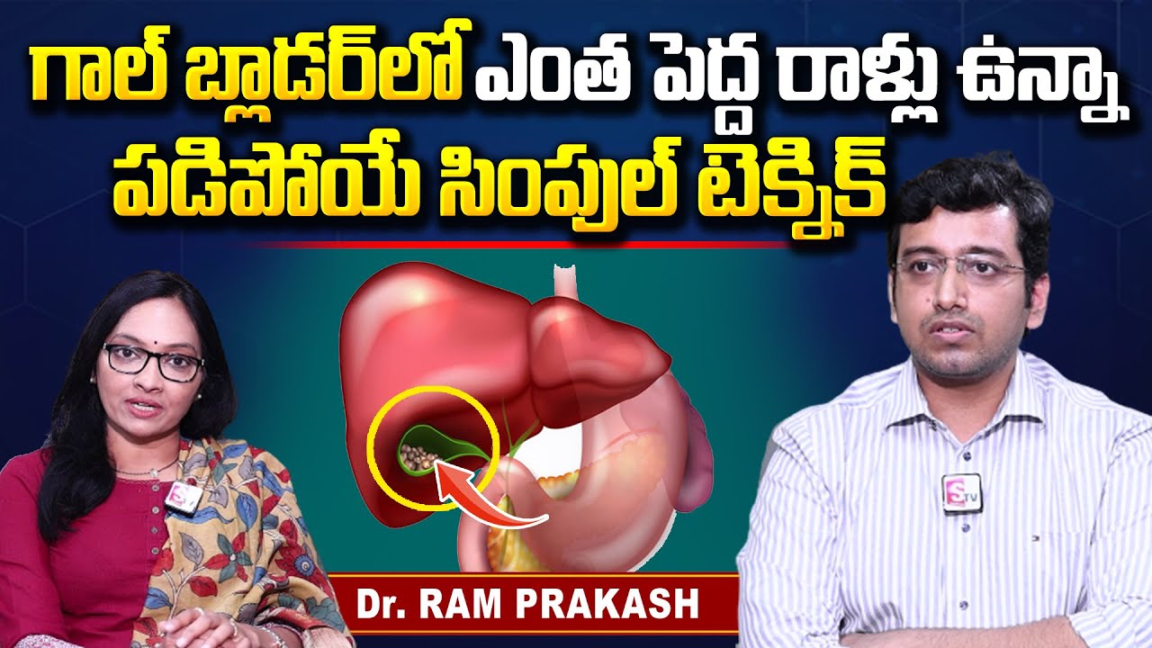 గాల్ బ్లాడర్ లో ఎంతటి రాళ్లు అయినా పడిపోయే సింపుల్ టెక్నిక్ | Dr Ram Prakash | HARINI Hospitals