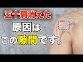 【五十肩が消えた】五十肩の激痛、動かないは「ここの隙間」の癒着でした。