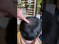 薄毛のオデコがスーパーミリオンヘアーのファンデーションを使ってみたら… #shorts #薄毛 #スーパーミリオンヘアー #白髪