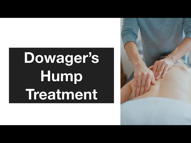 Combatting Dowager's Hump: Prevention and Reduction Techniques for