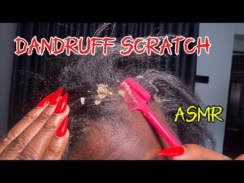 ASMR Dandruff Scratching | Scalp Scratching with Comb 