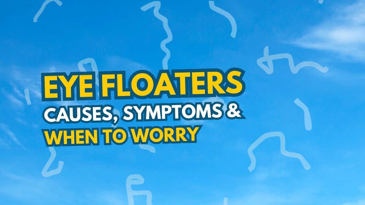 Eye Floaters: Causes, Symptoms, and When to Worry | The Sight Avenue ...