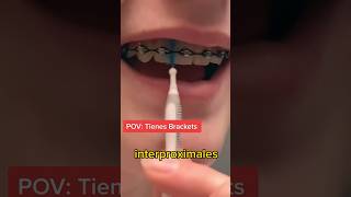 Aprende a LAVAR tus DIENTES CON BRACKETS como un PRO Resimi