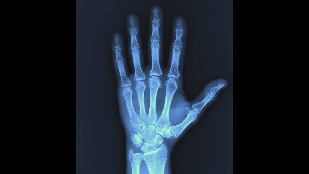X Ray Explained YouTube X Ray Explained YouTube