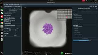 High-throughput screening of spheroid cell cultures using a novel microscope array