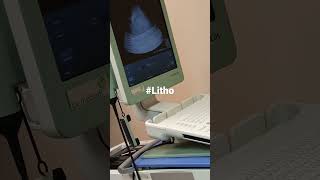 #life #subscribe #siemens #biomedicalengineering #radiology #urologist #bme