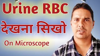 Urine rbc under microscope | How to identify urine rbc | How to count urine rbc