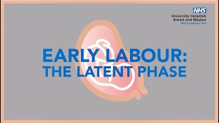 Early Labour  - The Latent Phase