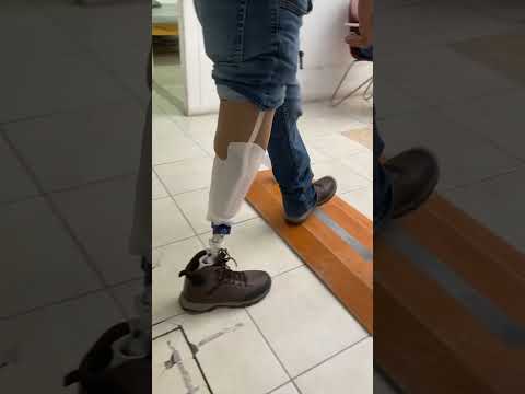 #amputee rehab transtibial
