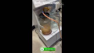 Belly lipo | Islamabad | Cosmetic Enclave | i-8 markaz