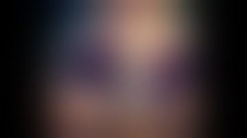 why splitting sylvian fissure from frontal side