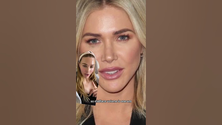 Replying to @user3288184154527 Procedures that improve face shape and proportions 💓 ill make a