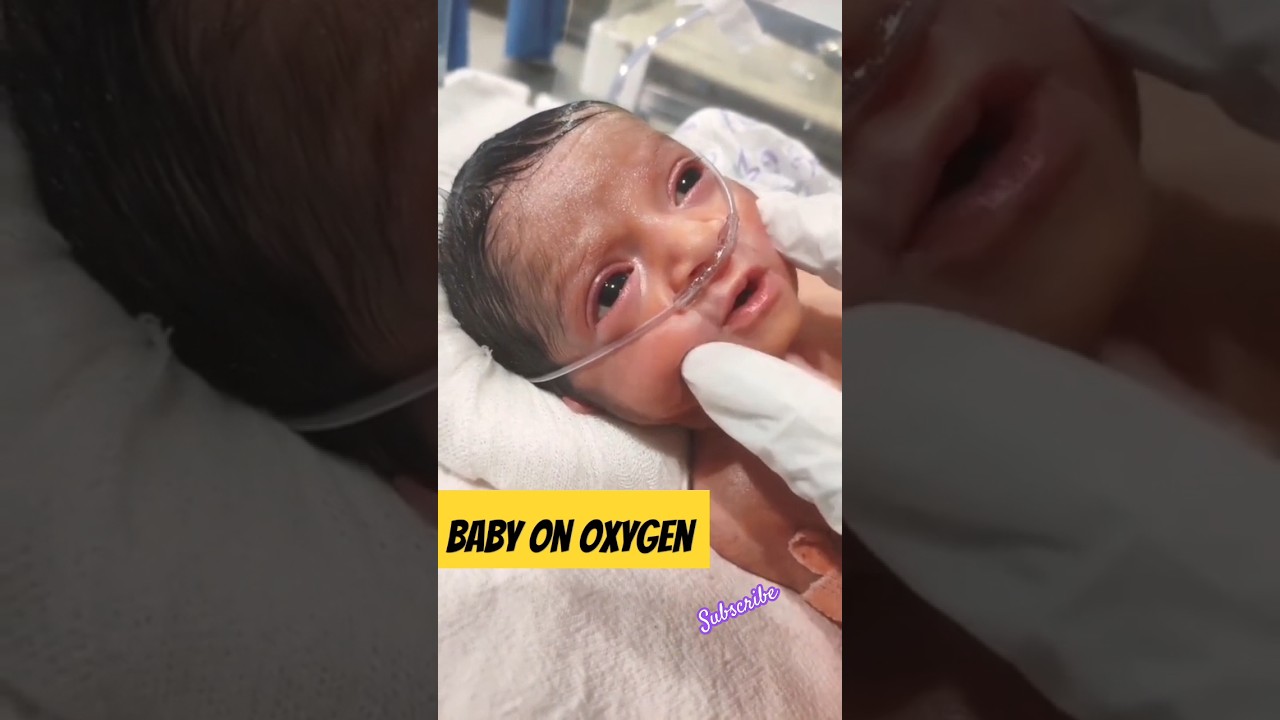 Baby On Oxygen Nasal support 
