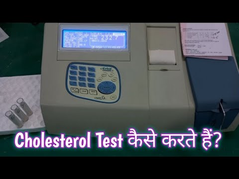 Cholesterol Test | Serum Cholesterol Test | Lipid Profile Test by CHOD/POD Method