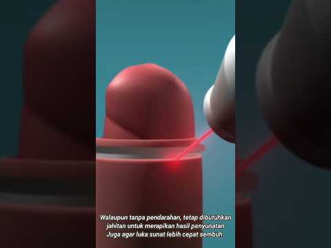 Video: Apa yang dilakukan alat laso di animate?