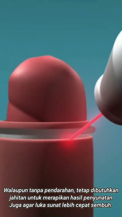 Animasi tutorial sunat laser || tutorial circumcision electrical cauter animation ||