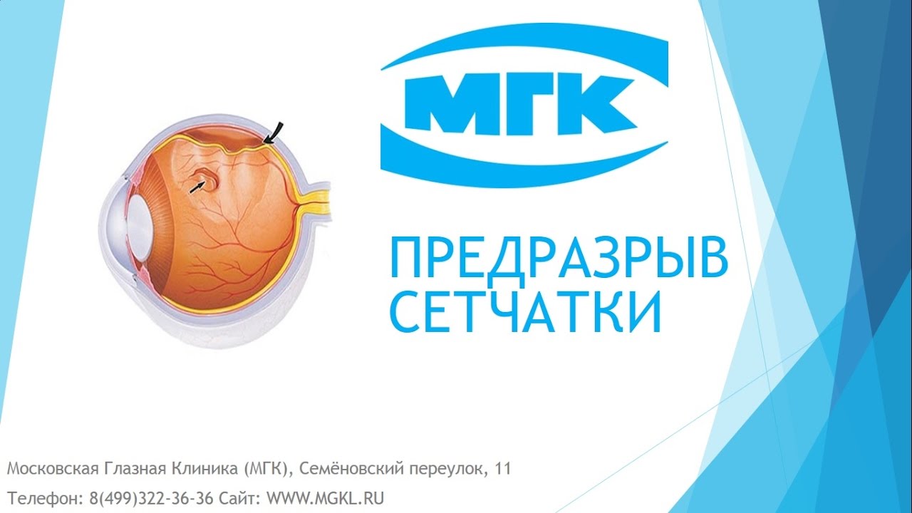 Предразрывы сетчатки глаза что это такое, лечение