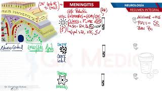 Neurología  Meningitis