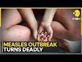 Bangladesh Measles Outbreak: Daily Death Toll Spikes as Virus Spreads Unchecked | WION News