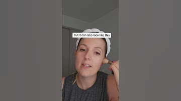 Reminder of what it looks like having a chronic illness #chronicillness #reminder #disability