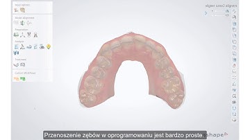 3Shape Clear Aligner Studio - Demo of 3shape Virtual Sub-setup for Clear Aligners PL