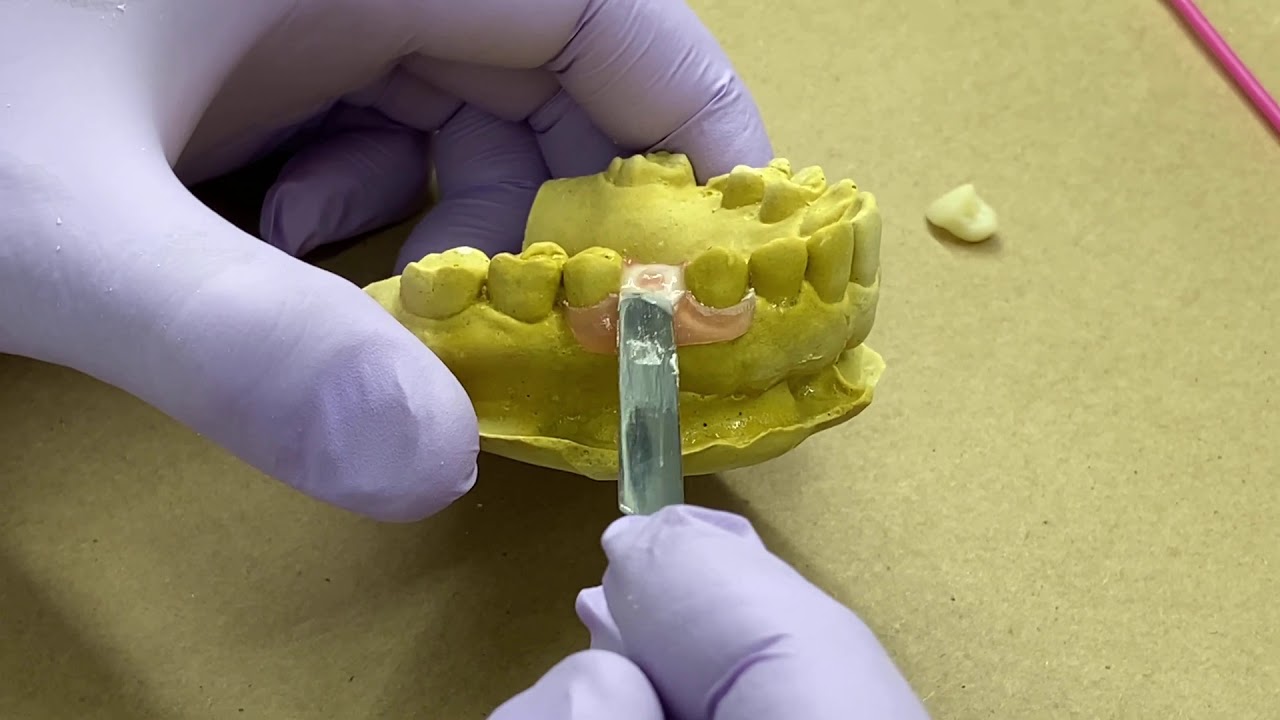 How to Attach Teeth to Myerson Duraflex™ Partials YouTube