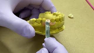 How to Attach Teeth to Myerson Duraflex™ Partials