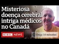 A doença cerebral misteriosa que intriga médicos no Canadá | Ouça 10 minutos