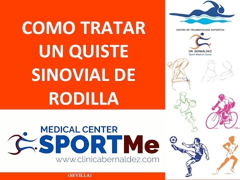 COMO TRATAR UN QUISTE SINOVIAL RODILLA