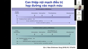 Chẩn đoán và can thiệp đường vào mạch máu ở BN chạy thận nhân tạo. Phần 2